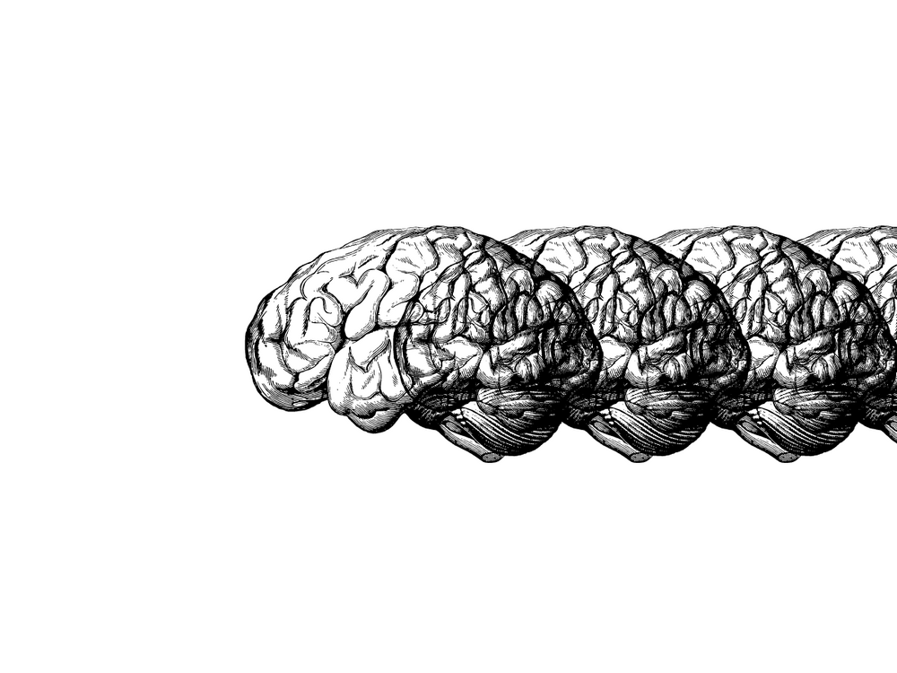 What is neurodiversity, four brains, black and white, on a line.